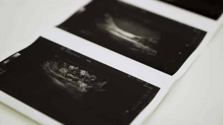 Read more about the article Understanding Your Ultrasound Results: A Guide for Patients